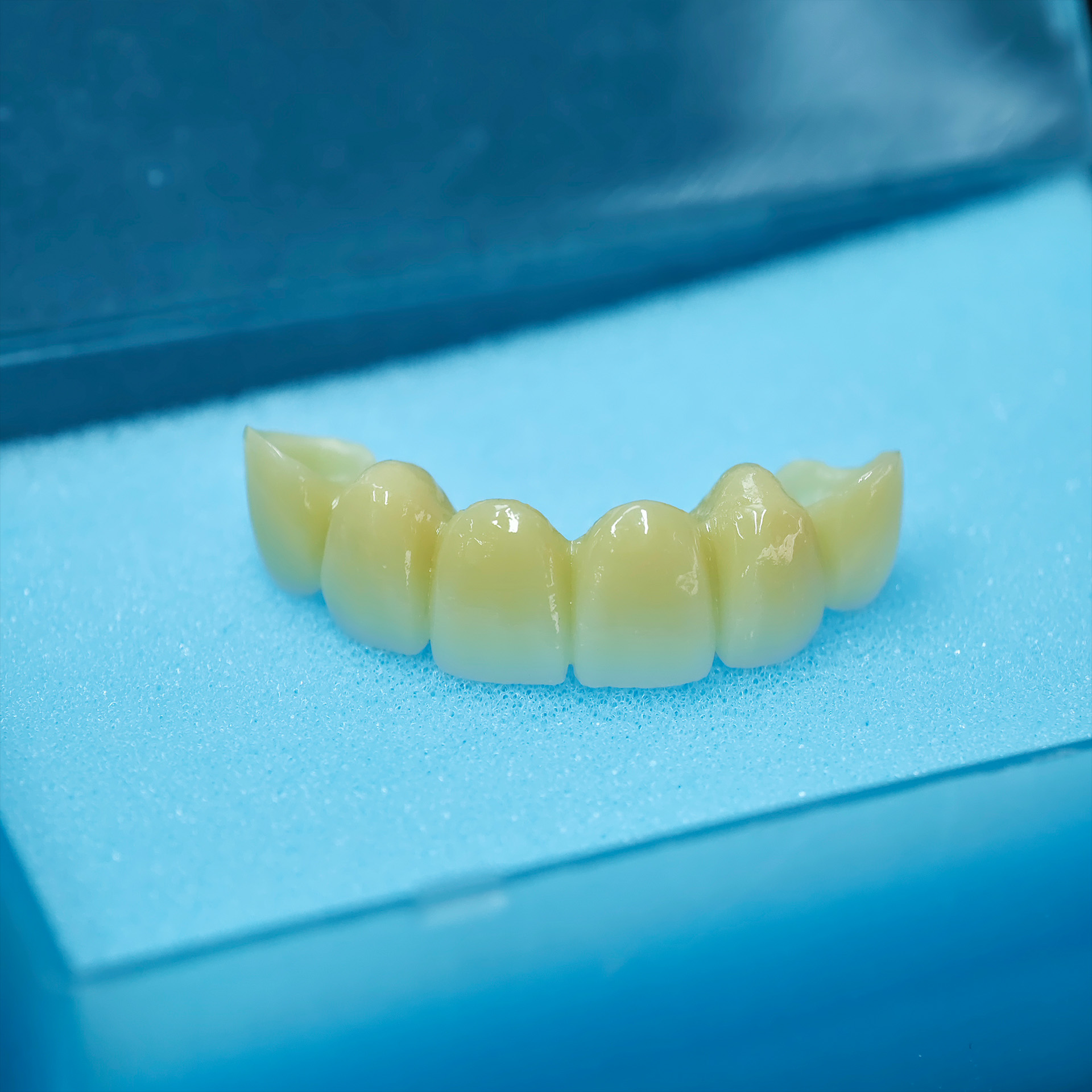 High - Strength Zirconia Bridg