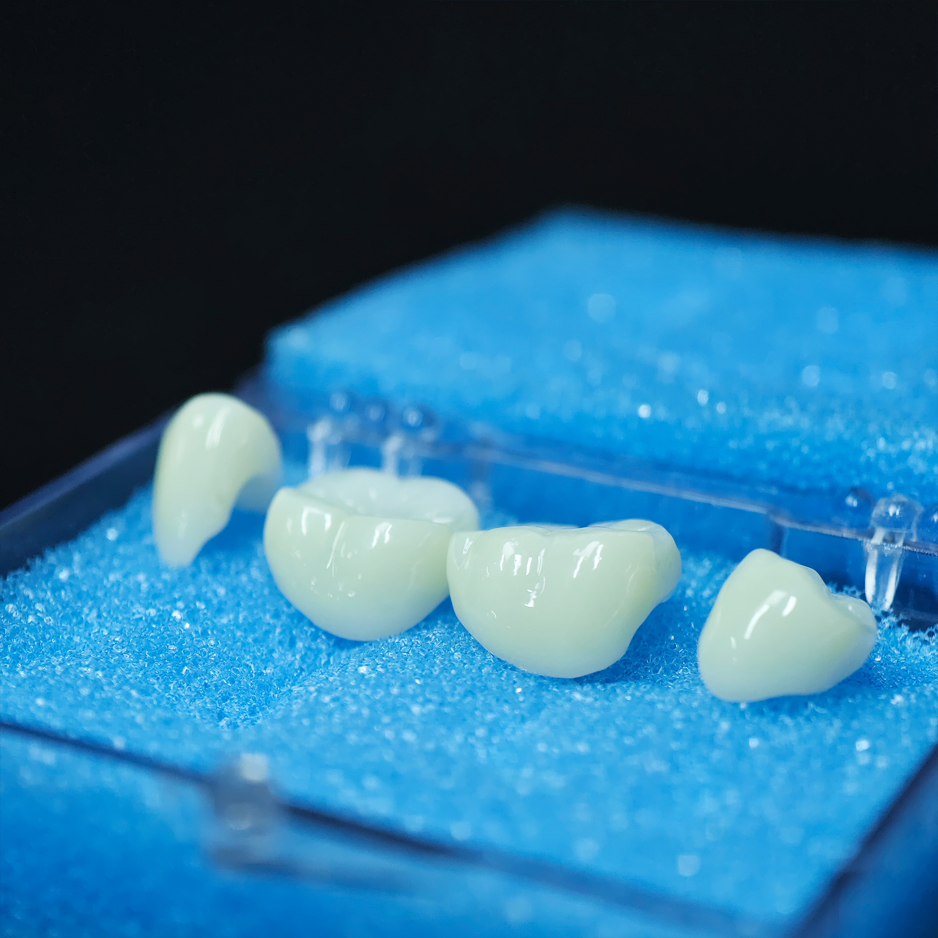 High - Strength Zirconia crown