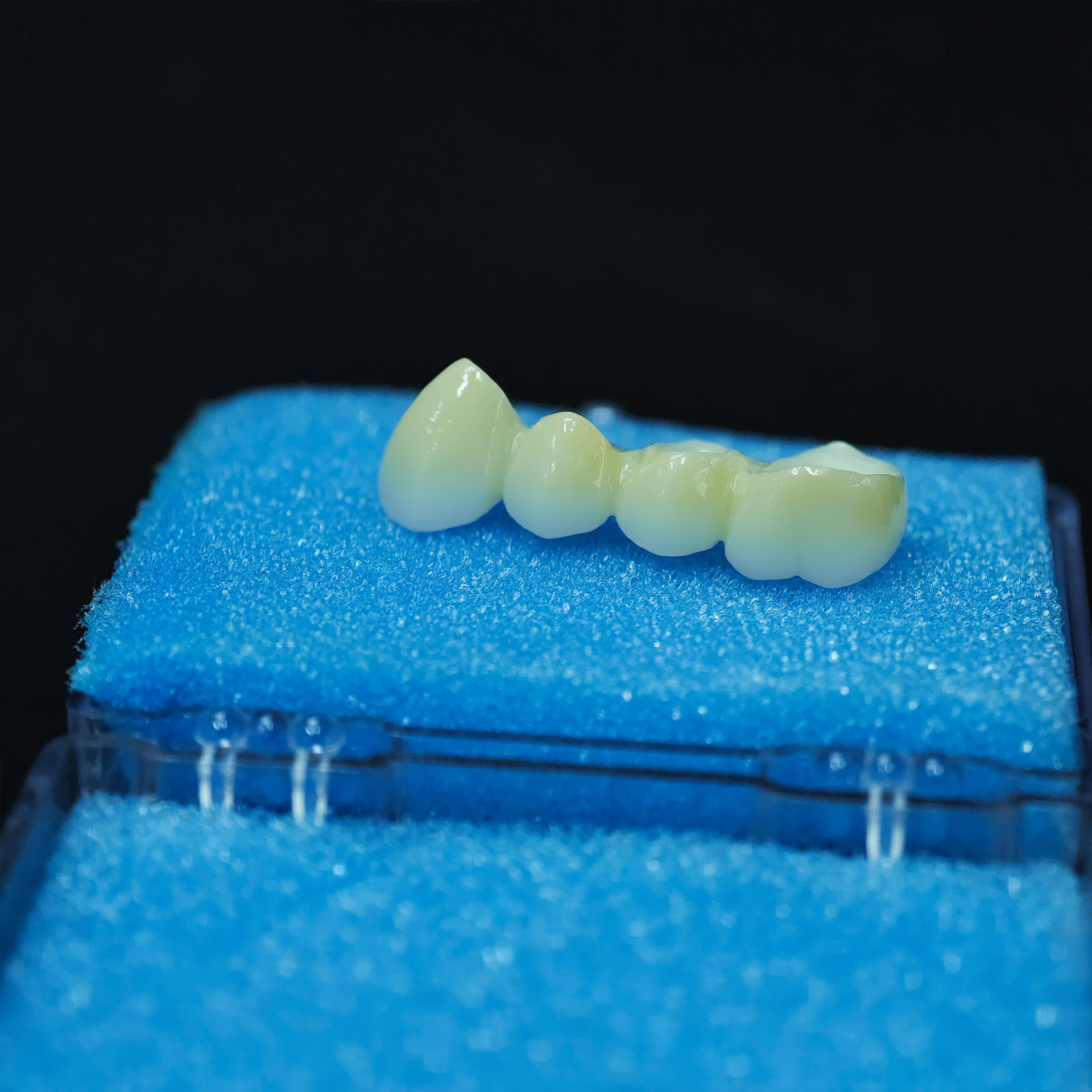 High - Strength Zirconia bridg