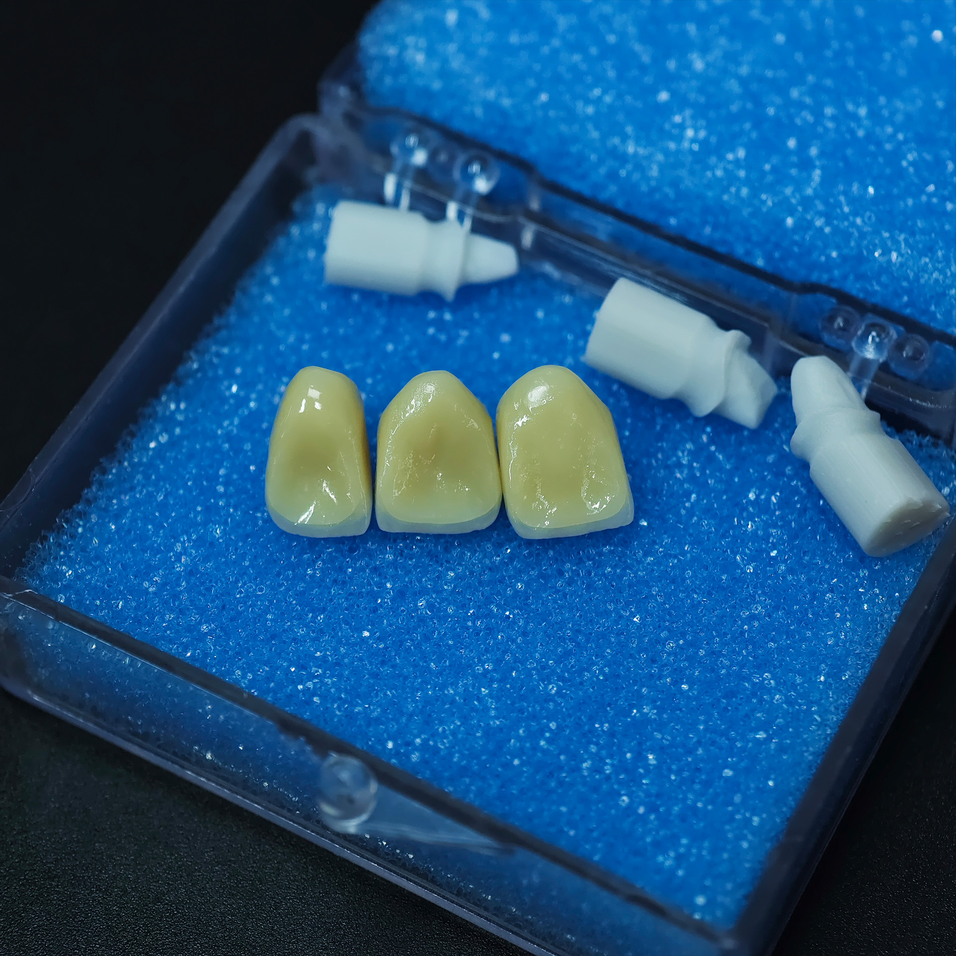 Aesthetic zirconia crowns(PFZ)