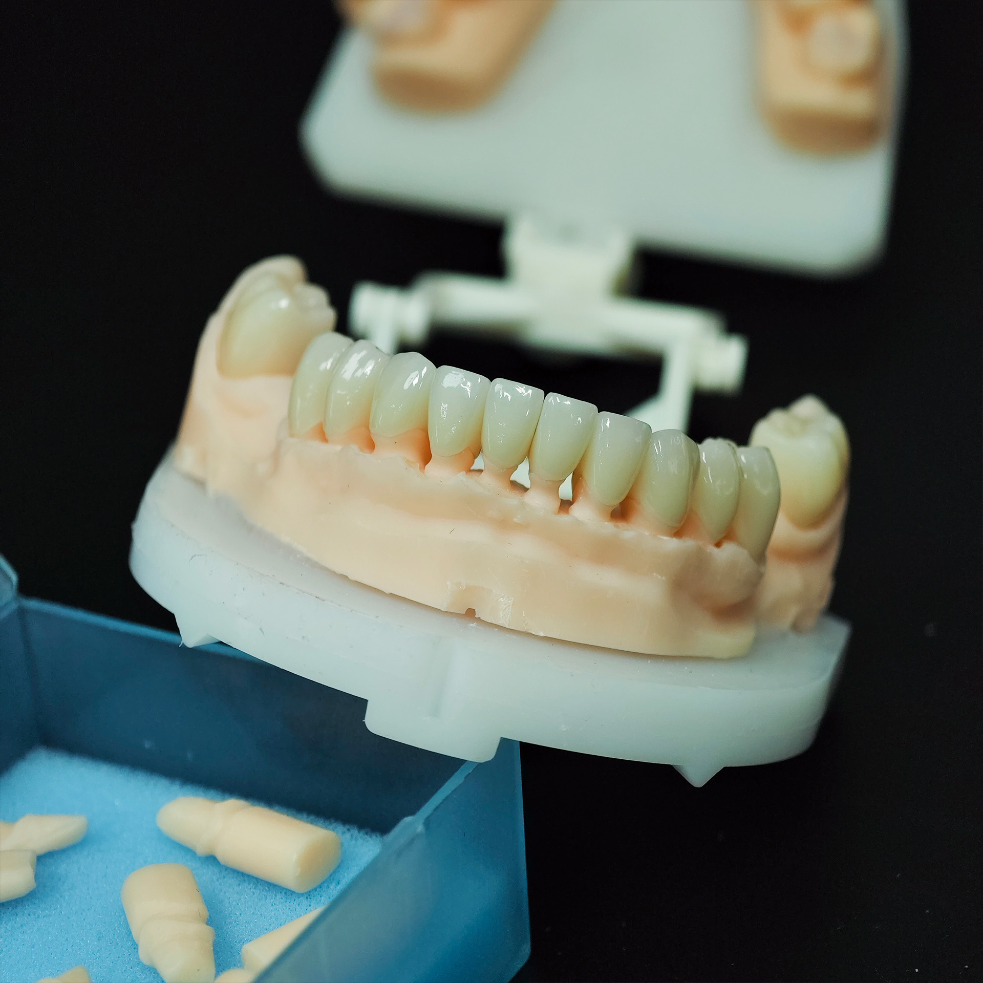 High - Strength Zirconia crown