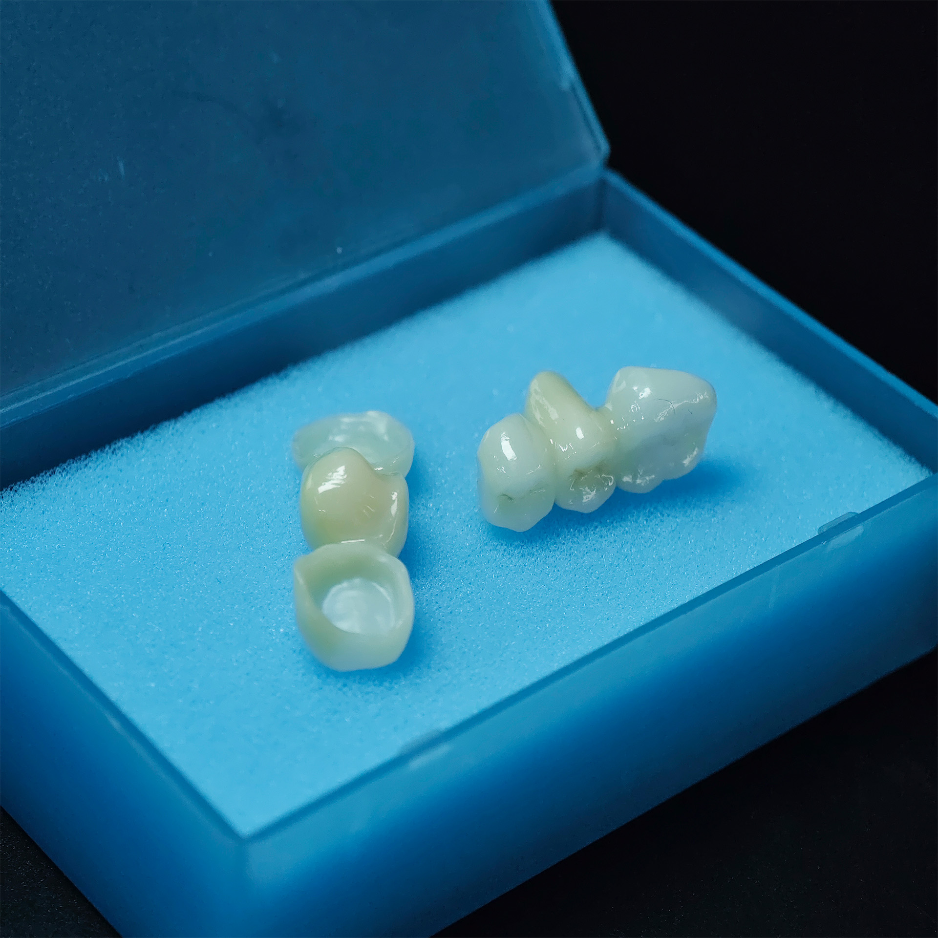 High - Strength Zirconia bridg