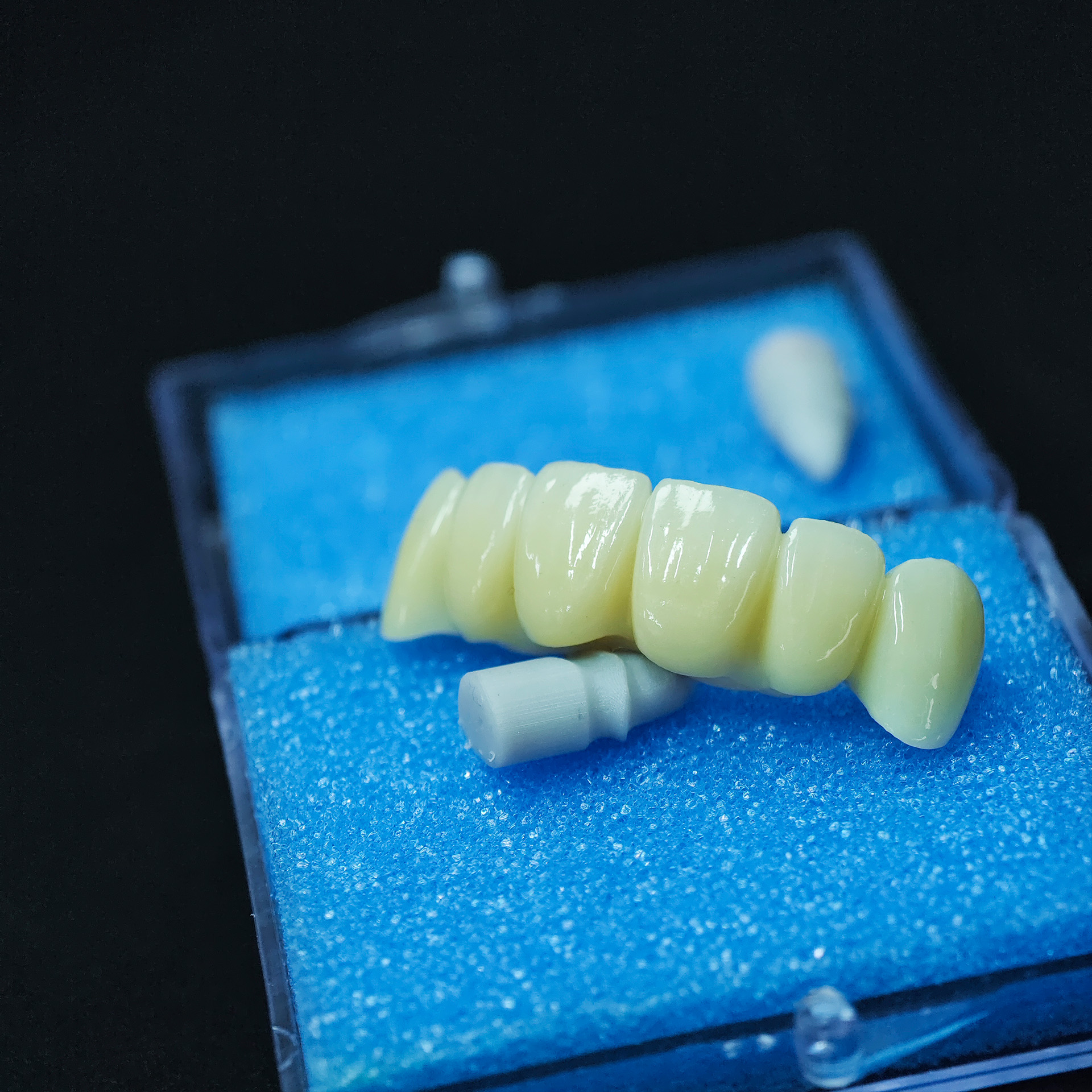 High - Strength Zirconia bridg
