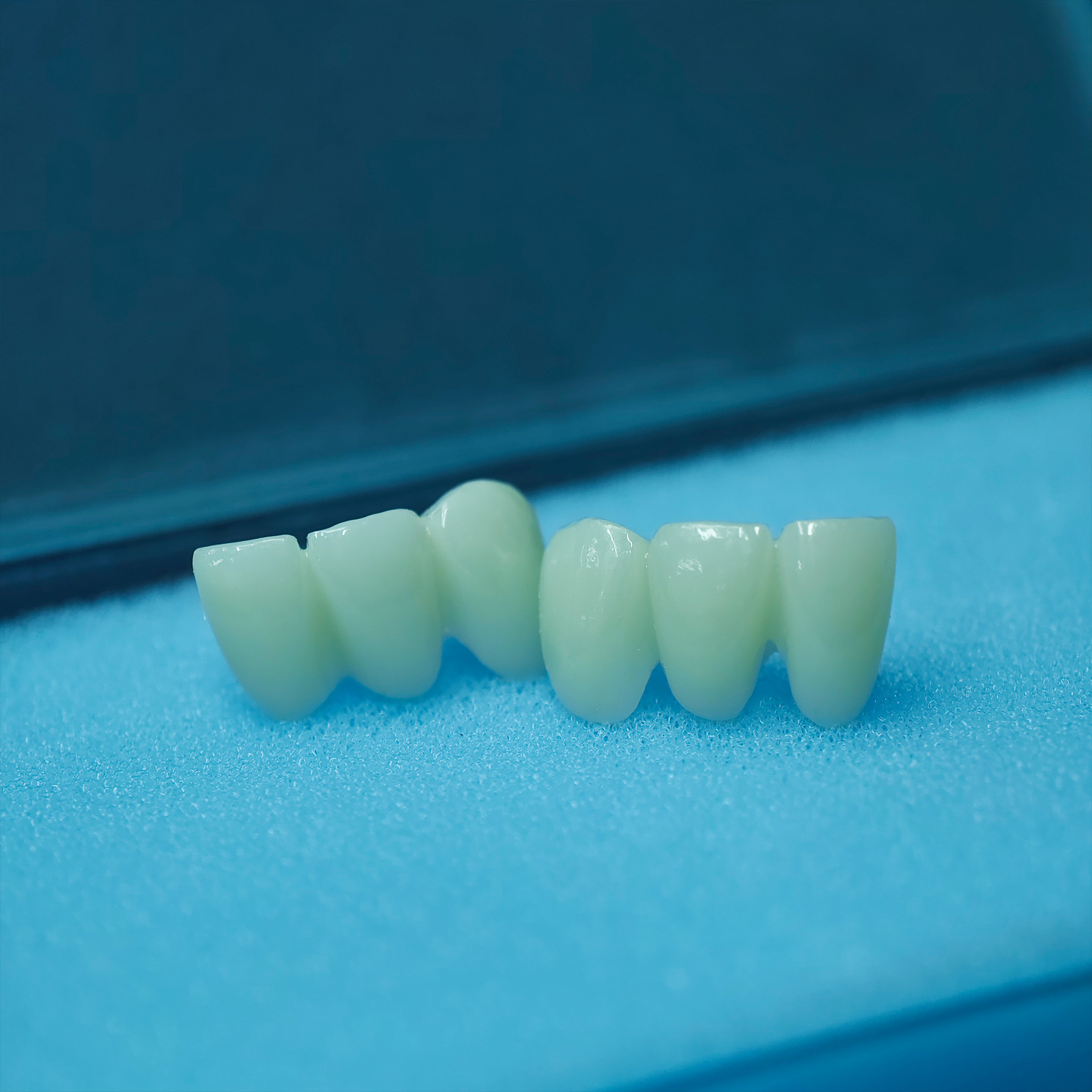 High - Strength Zirconia bridg