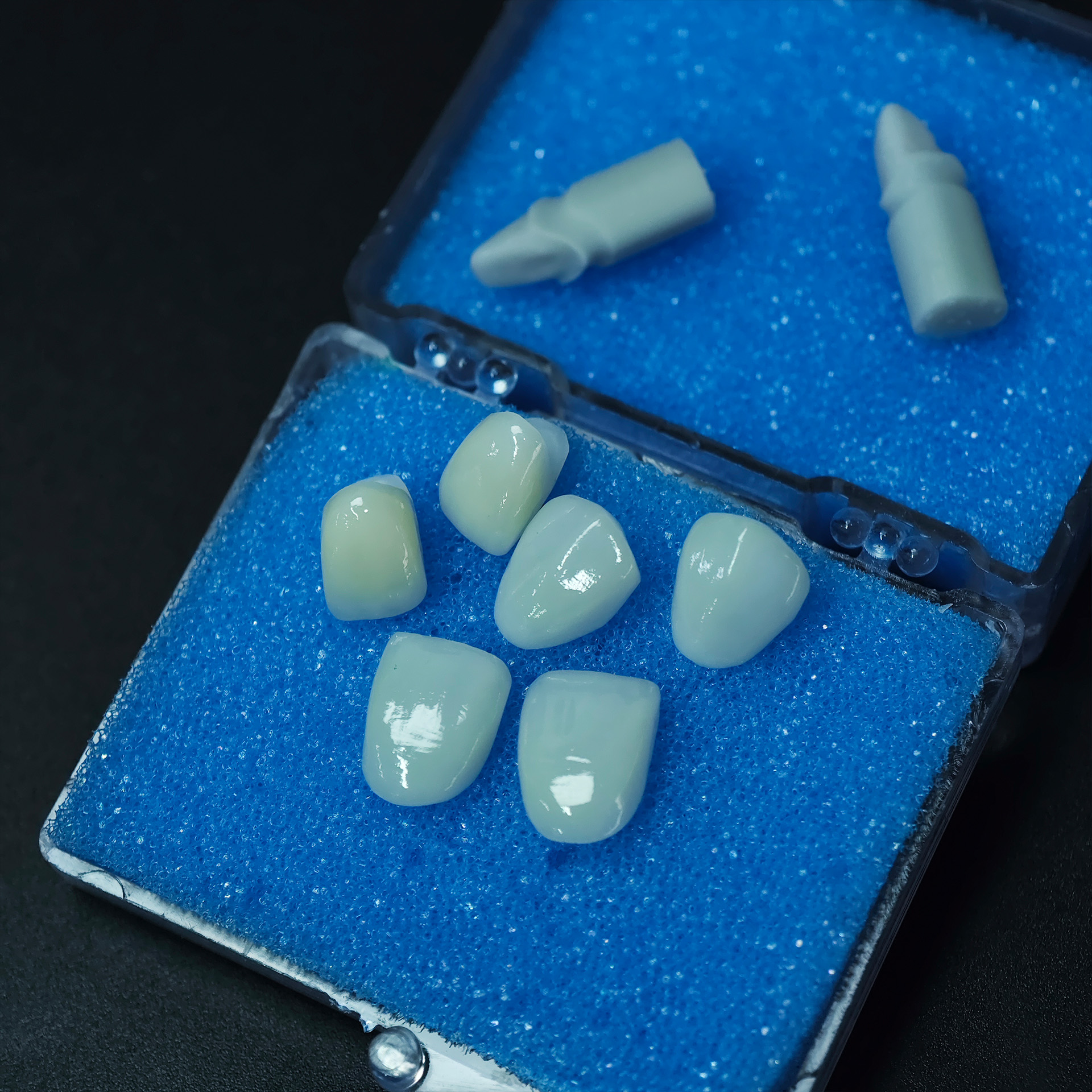 Ultra-thin emax veneer. High t