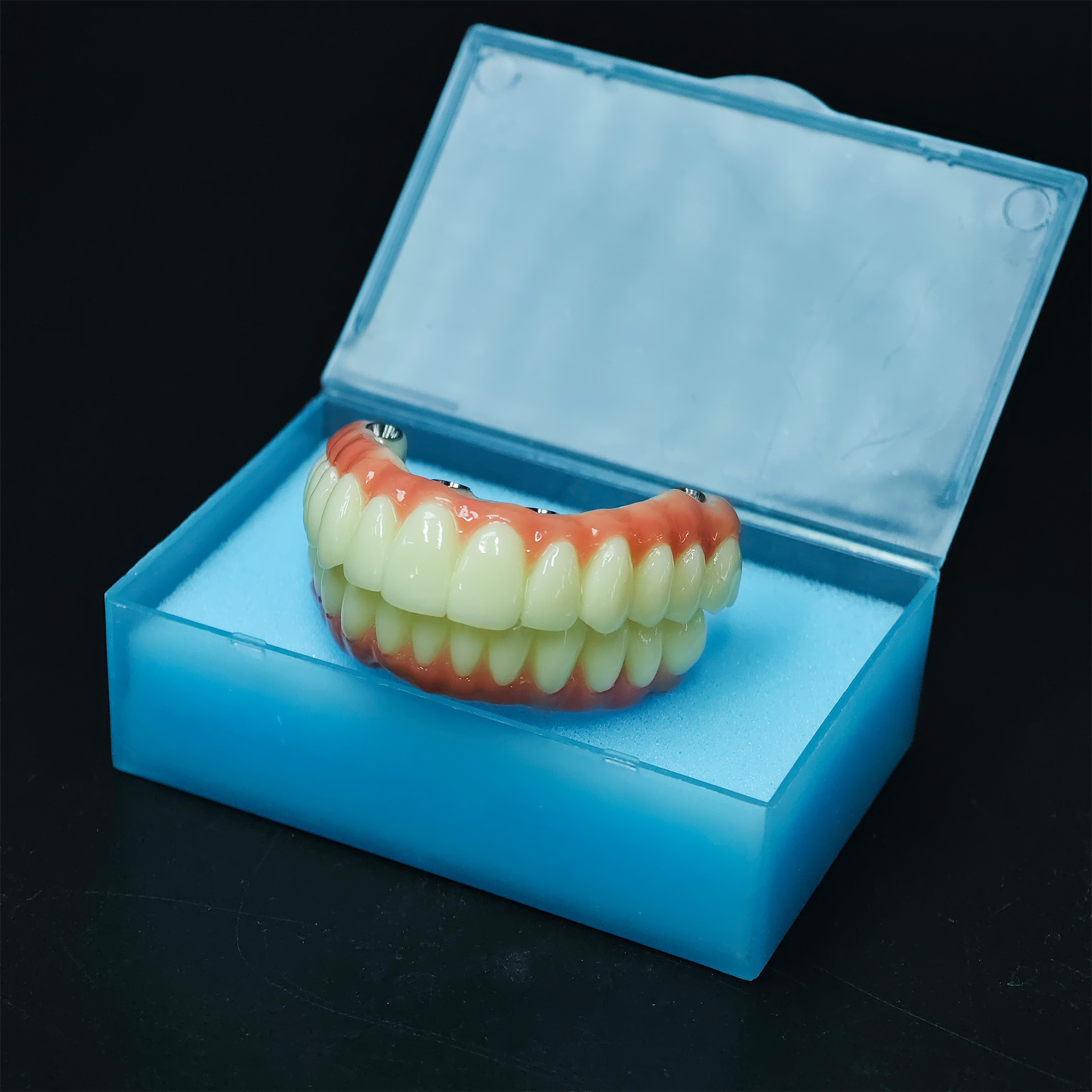 Full-arch PMMA bridge with ti-