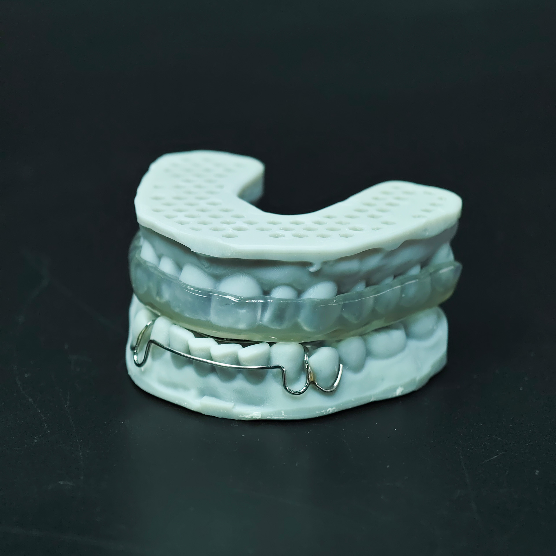 Hard splint and Removable Appl