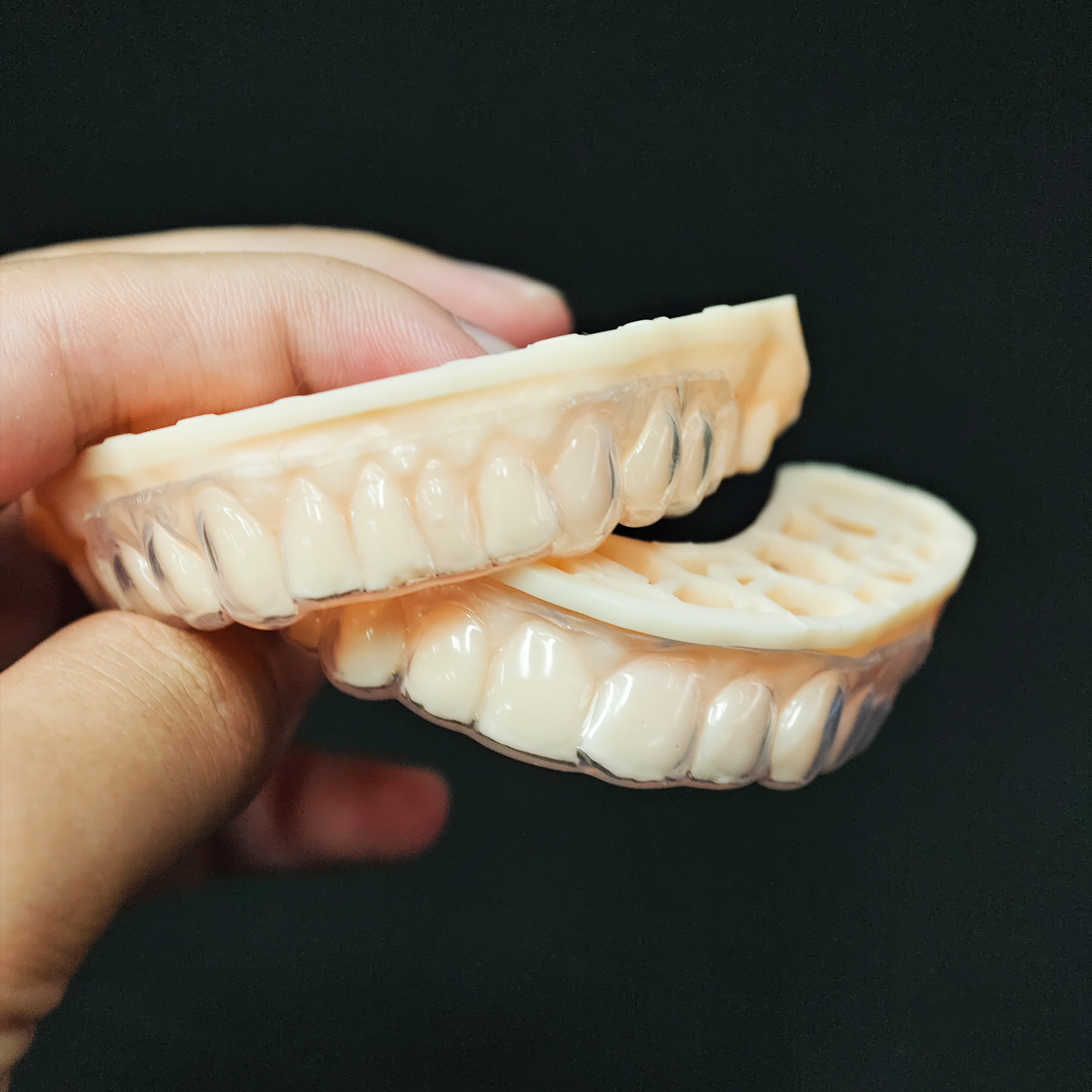 Soft Splint – Full-Arch Protec