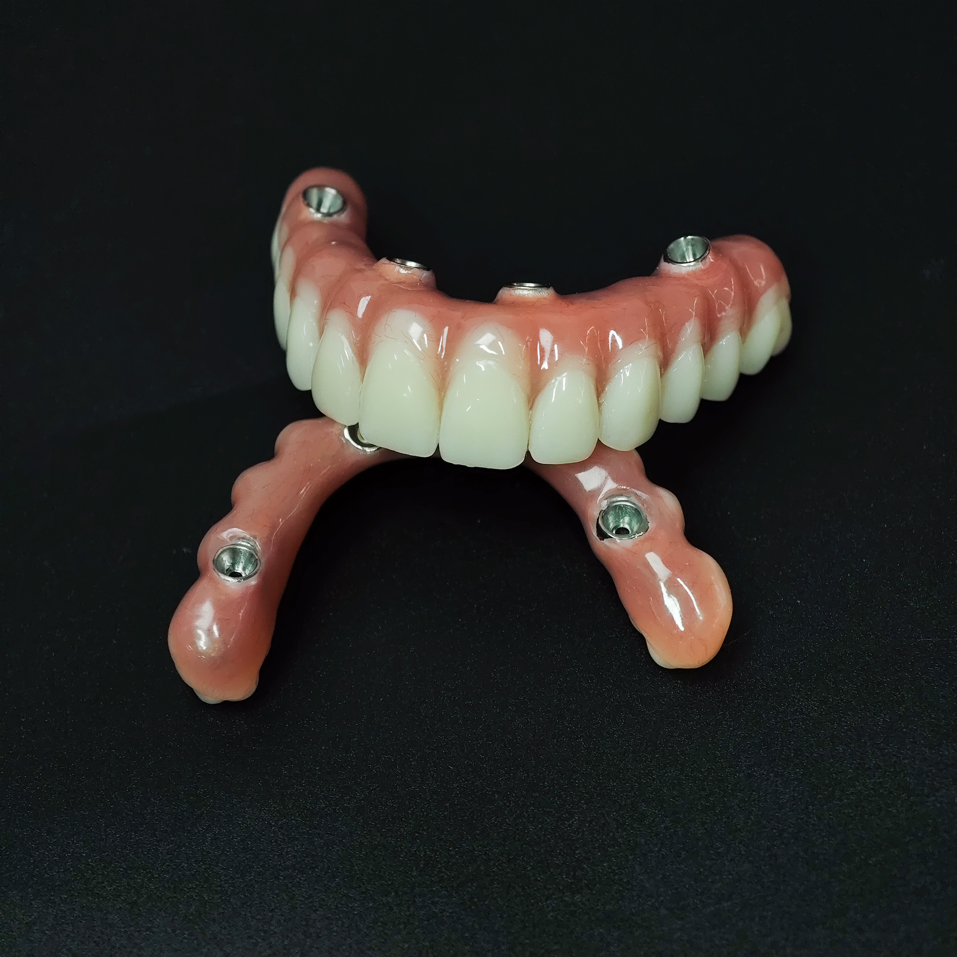 Full-arch acrylic denture with