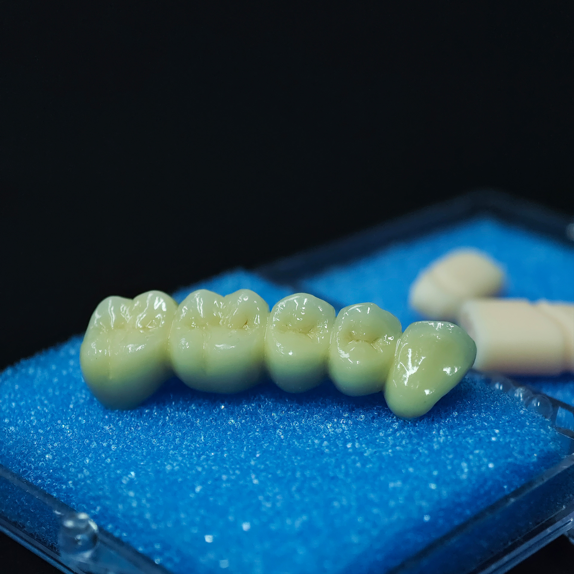 Co - Cr PFM Dental bridge